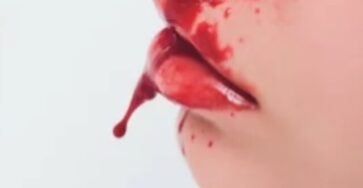 NOSE BLEED