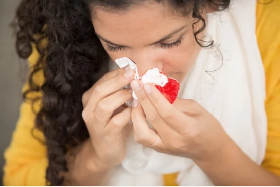 HOW TO TREAT A NOSE BLEED AT HOME