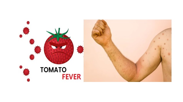 TOMATO FEVER