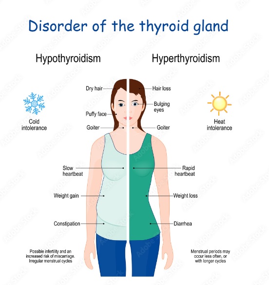 Disorder of the Thyroid Gland
