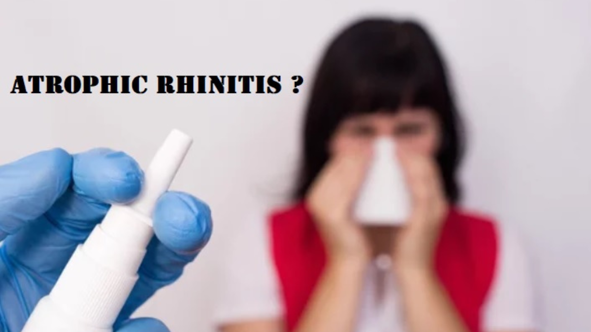 ATROPHIC RHINITIS